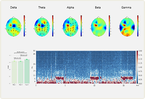 EEG analysis software