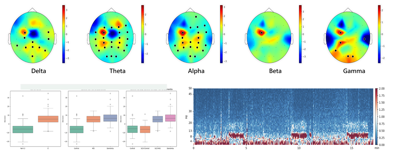 EEG Analysis Visualization