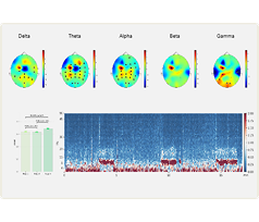 EEG data analysis methods