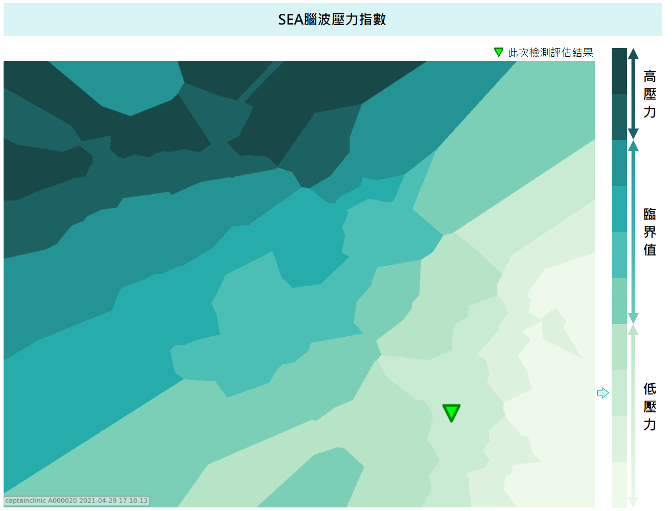 腦波地圖